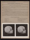 Cranio-Cerebral Topography - no. 2